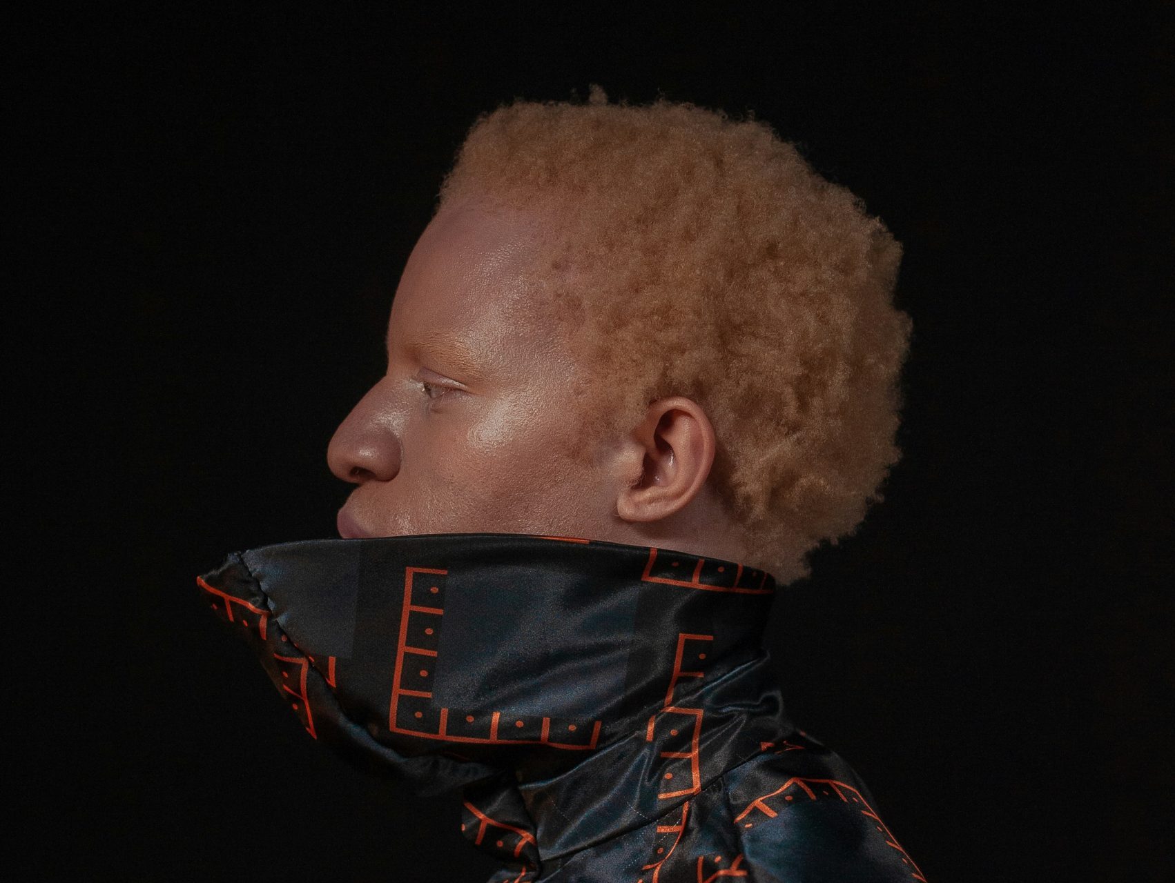 ‘Tiny’ Skin Mutation: Rethinking the Origins of Race Relations